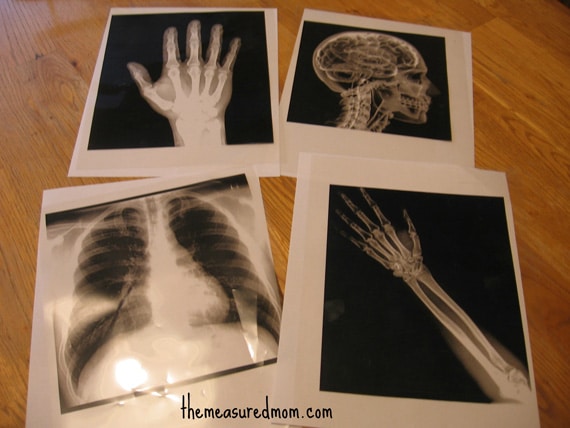 X-ray pictures